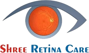 Shree retina care